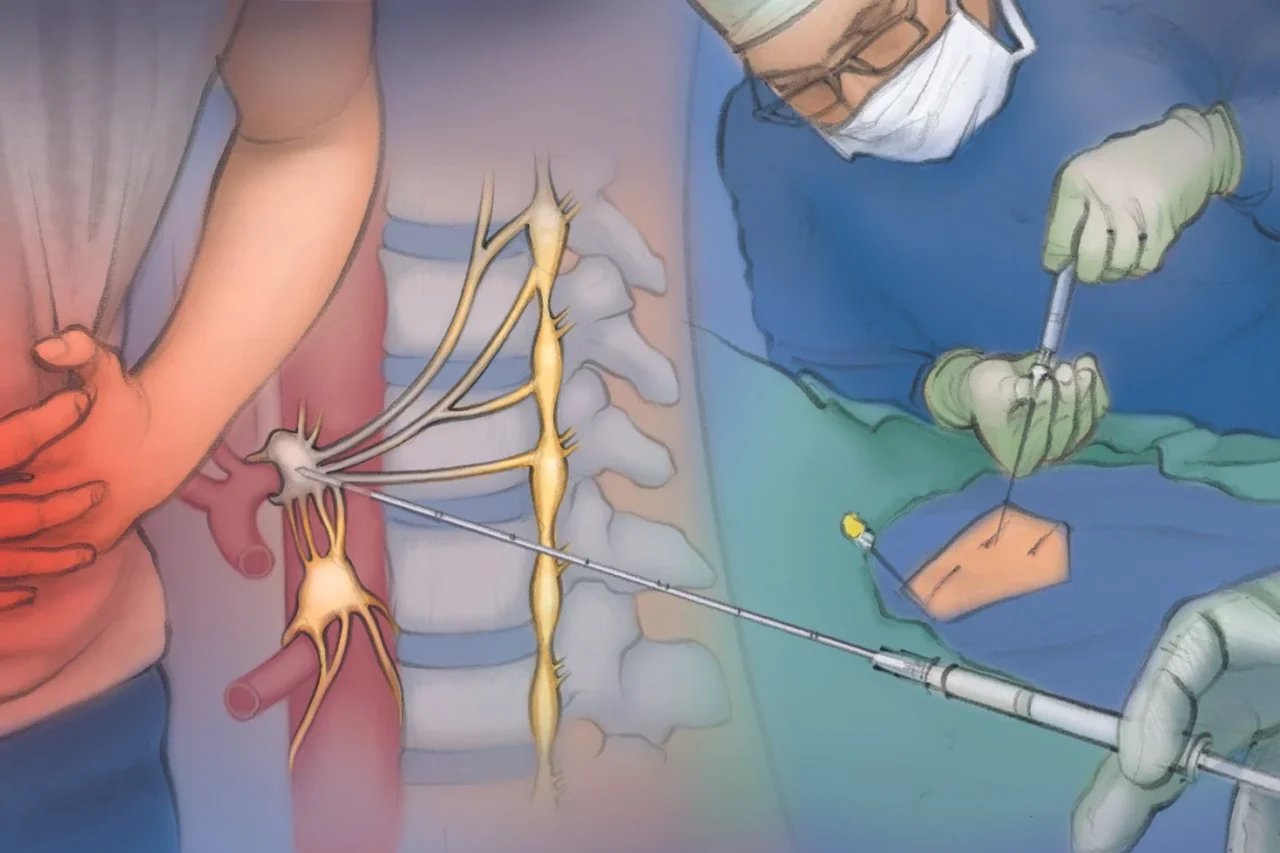 nerve_block_neurolysis